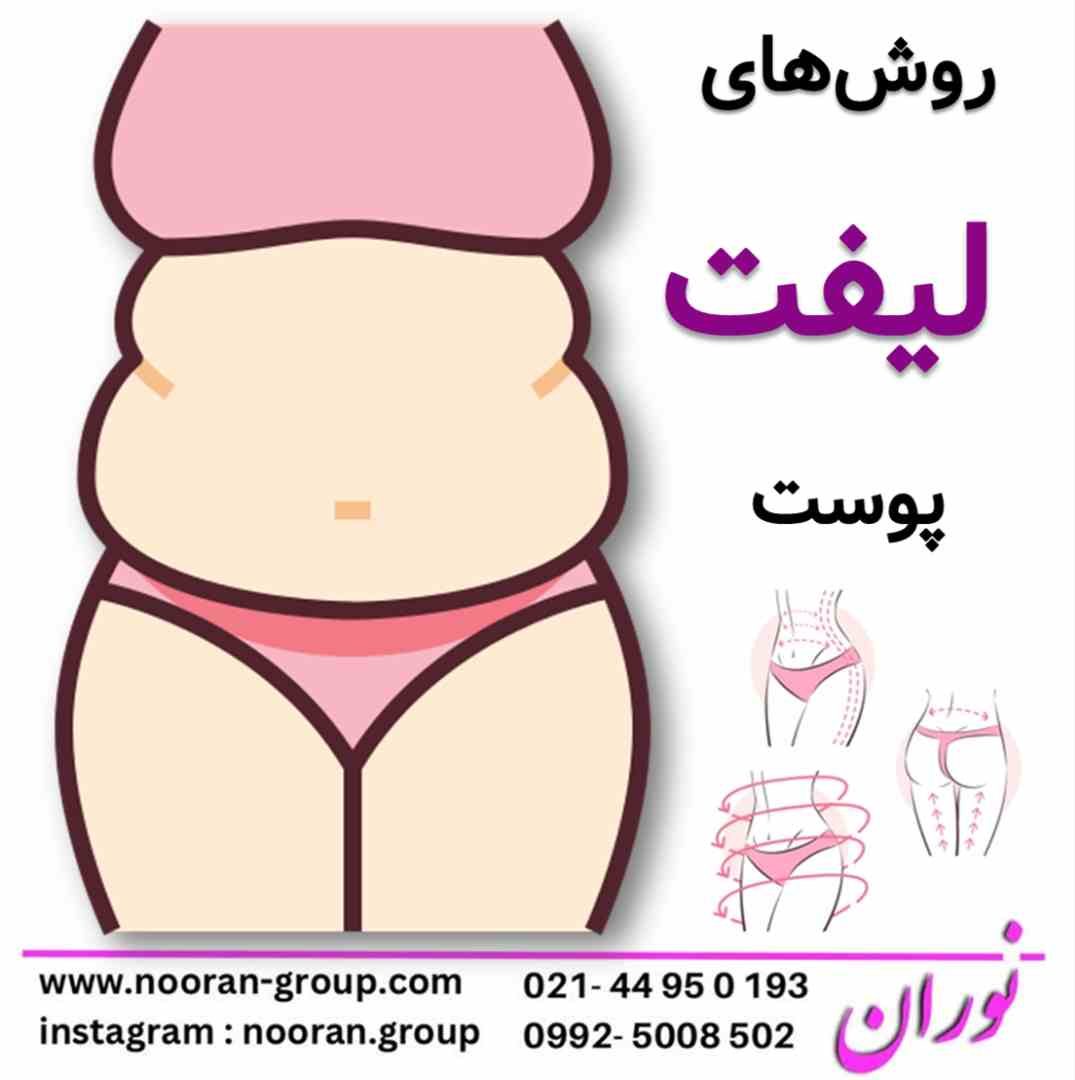 روشهای لیفت پوست شکم و بازو: دستیابی به پوستی سفتتر و جوانتر