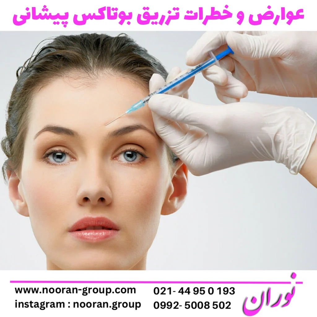 همه چیز درباره بوتاکس پیشانی