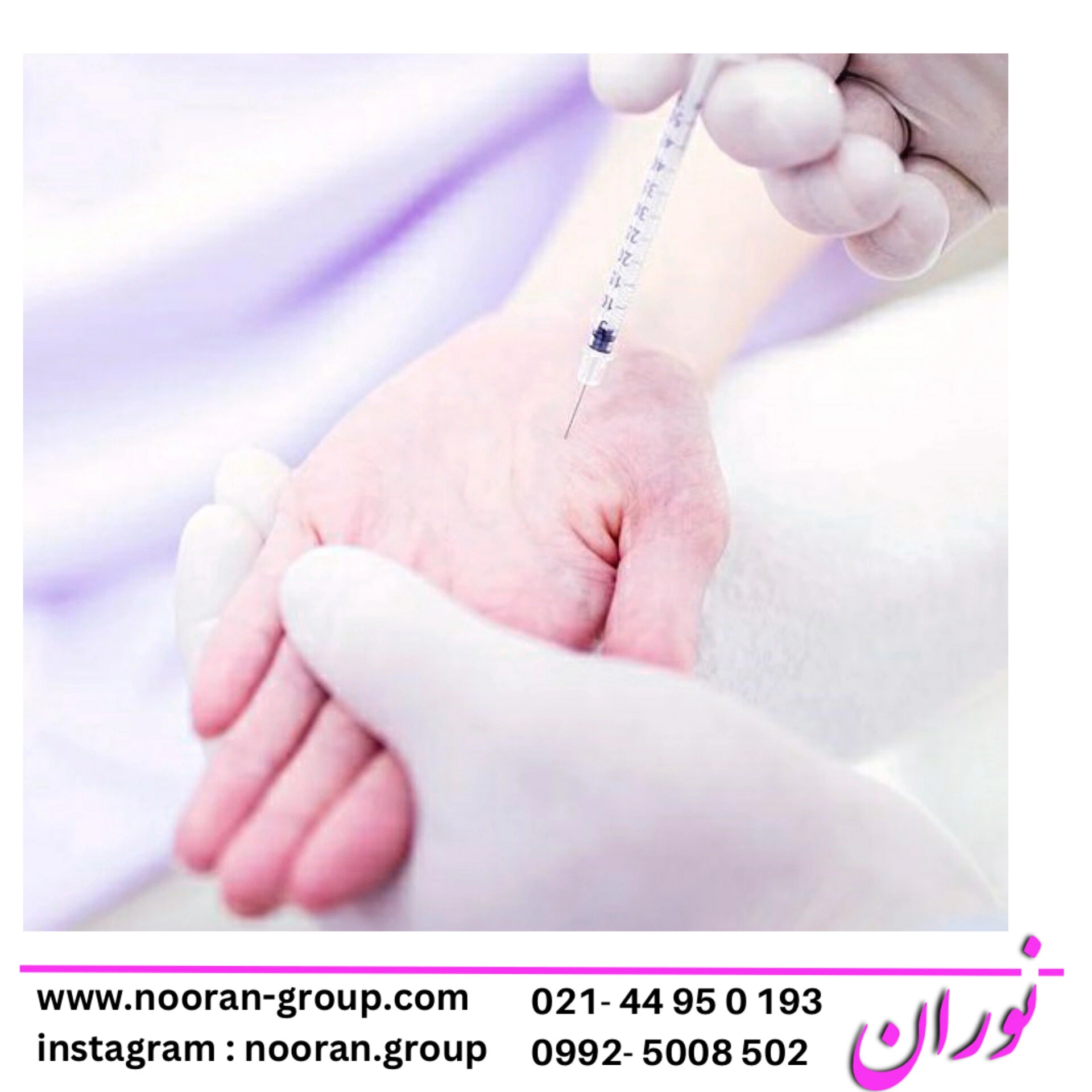 همه چیز درباره بوتاکس کف دست