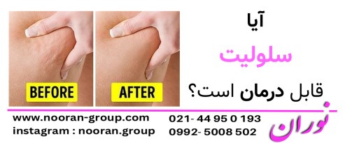 آیا سلولیت قابل درمان است؟