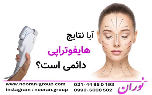 آیا نتایج هایفوتراپی دائمی است؟