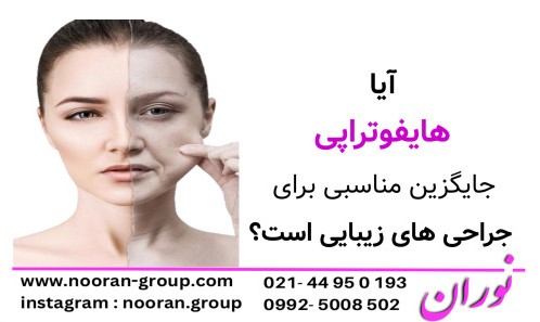 آیا هایفوتراپی جایگزین مناسبی برای جراحی‌های زیبایی است؟