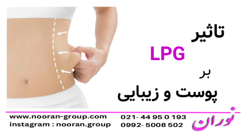 تاثیر LPG بر روی پوست و زیبایی