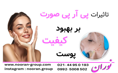تاثیرات پی آر پی صورت بر بهبود کیفیت پوست