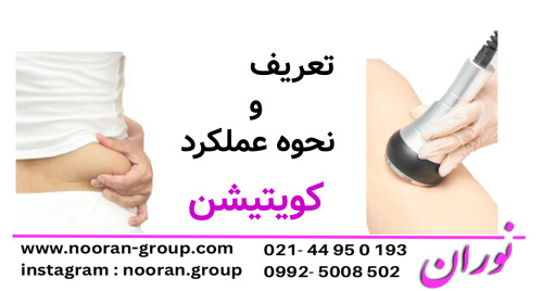 تعریف و نحوه عملکرد کویتیشن