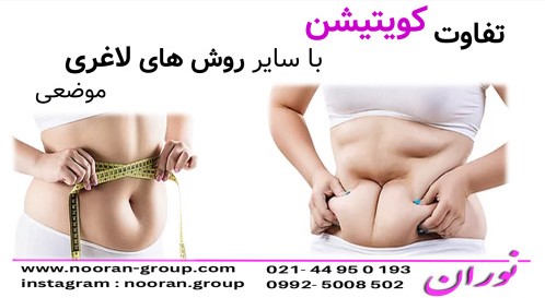 تفاوت کویتیشن با سایر روش‌های لاغری موضعی
