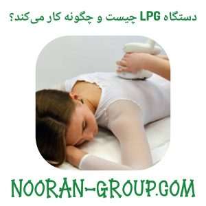 دستگاه LPG چیست و چگونه کار می‌کند؟