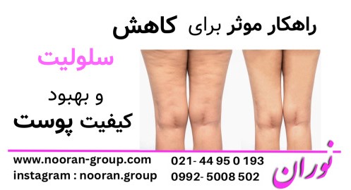 راهکارهای موثر برای کاهش سلولیت و بهبود کیفیت پوست