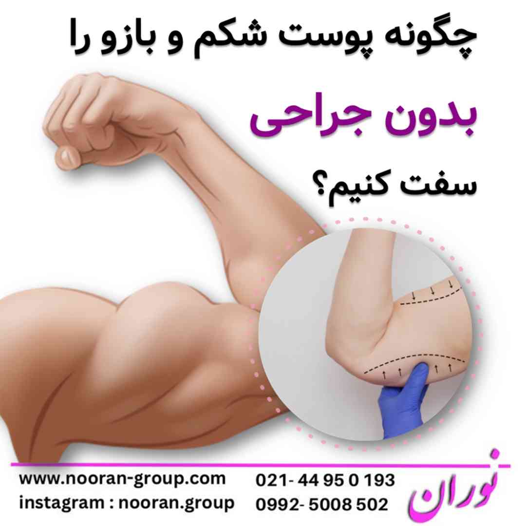 چگونه پوست شکم و بازو را بدون جراحی سفت کنیم؟