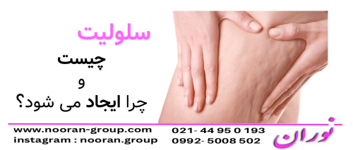 سلولیت چرا ایجاد می‌شود؟