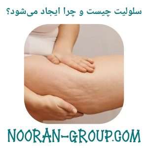 سلولیت چیست و چرا ایجاد می‌شود؟