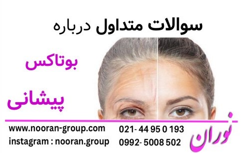 سوالات متداول درباره بوتاکس پیشانی