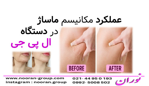 عملكرد مكانيسم ماساژ در دستگاه ال پي جي