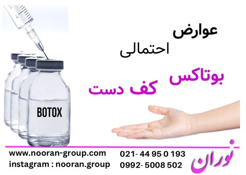 عوارض احتمالی بوتاکس کف دست