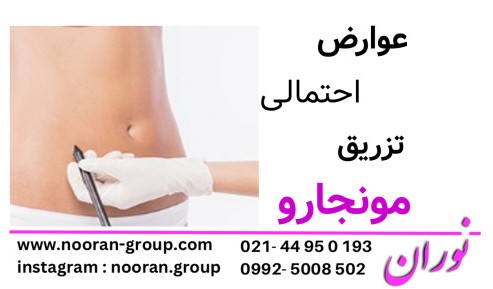 عوارض احتمالی تزریق مونجارو