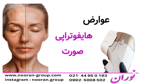 عوارض هایفوتراپی صورت