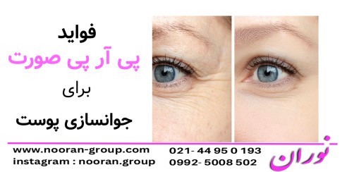 فواید پی آر پی صورت برای جوانسازی پوست