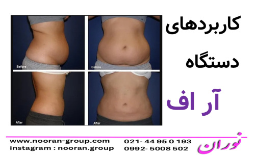 كاربردهاي دستگاه آر اف