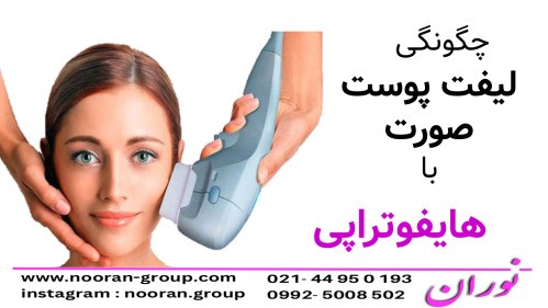 لیفت پوست صورت با هایفوتراپی