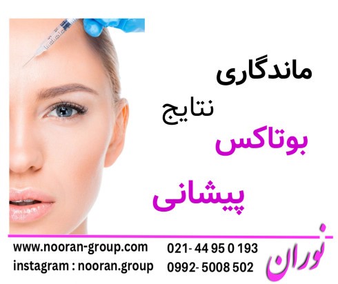 ماندگاری نتایج بوتاکس پیشانی