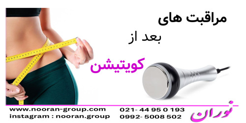 مراقبت های بعد از کویتیشن