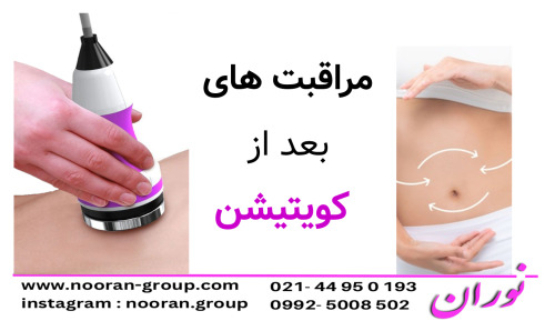 مراقبت های پس از کویتیشن