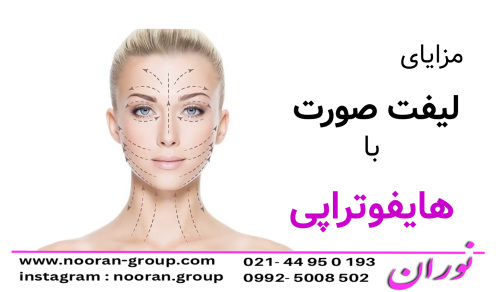 مزایای لیفت صورت با هایفوتراپی