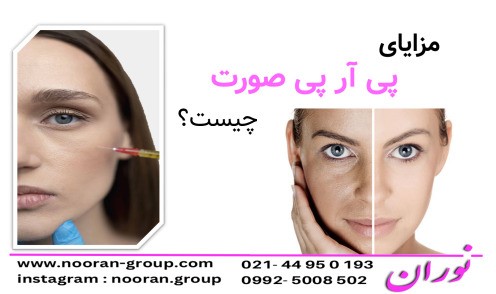 مزایای پی آر پی صورت چیست؟