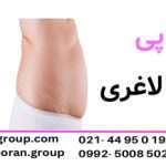 مزوتراپی برای لاغری