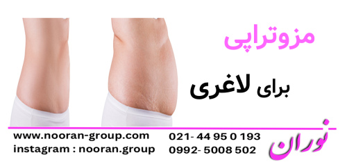 مزوتراپی برای لاغری