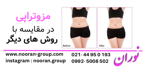مزوتراپی در مقایسه با روش‌های دیگر