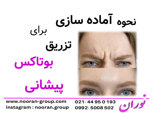 نحوه آماده‌سازی برای تزریق بوتاکس پیشانی