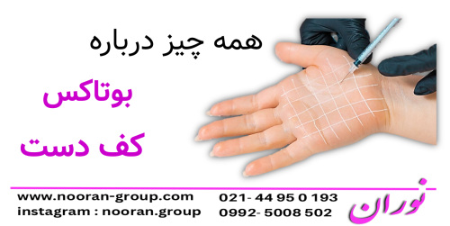 همه چیز درباره بوتاکس کف دست