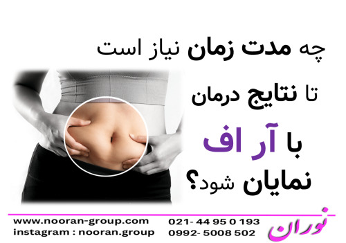 چه مدت زمان نیاز است تا نتایج درمان با آر اف نمایان شود؟