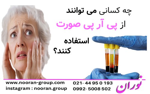 چه کسانی می‌توانند از پی آر پی صورت استفاده کنند؟