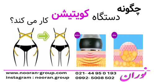 چگونه دستگاه کویتیشن کار می‌کند؟