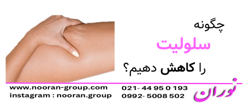 چگونه سلولیت را کاهش دهیم؟