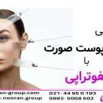 چگونگی لیفت پوست صورت با هایفوتراپی