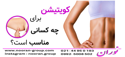 کویتیشن برای چه کسانی مناسب است؟