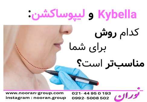 Kybella و لیپوساکشن کدام روش برای شما مناسب‌تر است؟