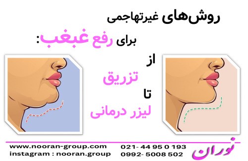 روش‌های غیرتهاجمی برای رفع غبغب از تزریق تا لیزر درمانی