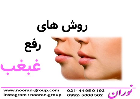 روش هاي رفع غبغب