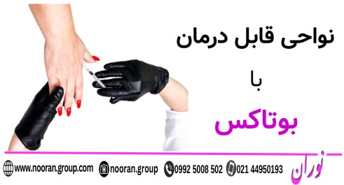 نواحی قابل درمان با بوتاکس
