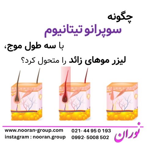 چگونه سوپرانو تیتانیوم با سه طول موج، لیزر موهای زائد را متحول کرد؟